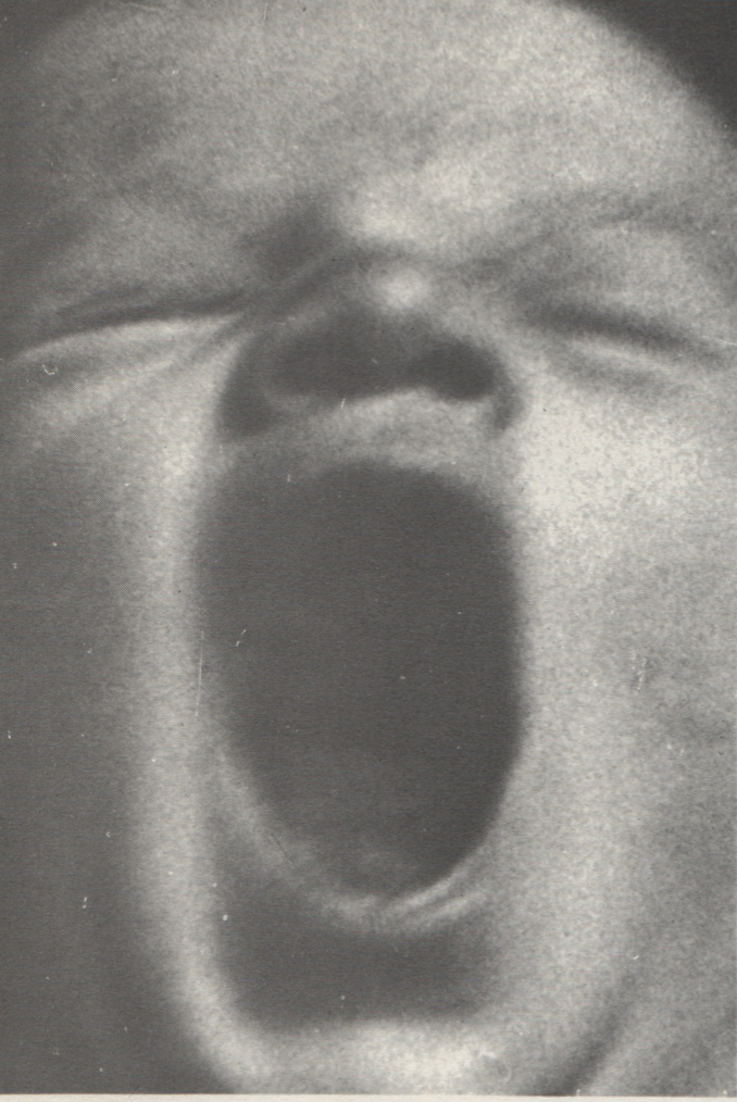 Close-up black-and-white photograph of the face of a baby with open mouth, possibly yawning or crying.