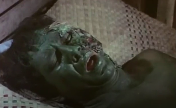 Color image of one of the islanders. The man is deep green in color, with a large rubbery glob on one side of his face.